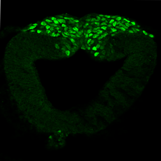 neural crest cells undergoing EMT